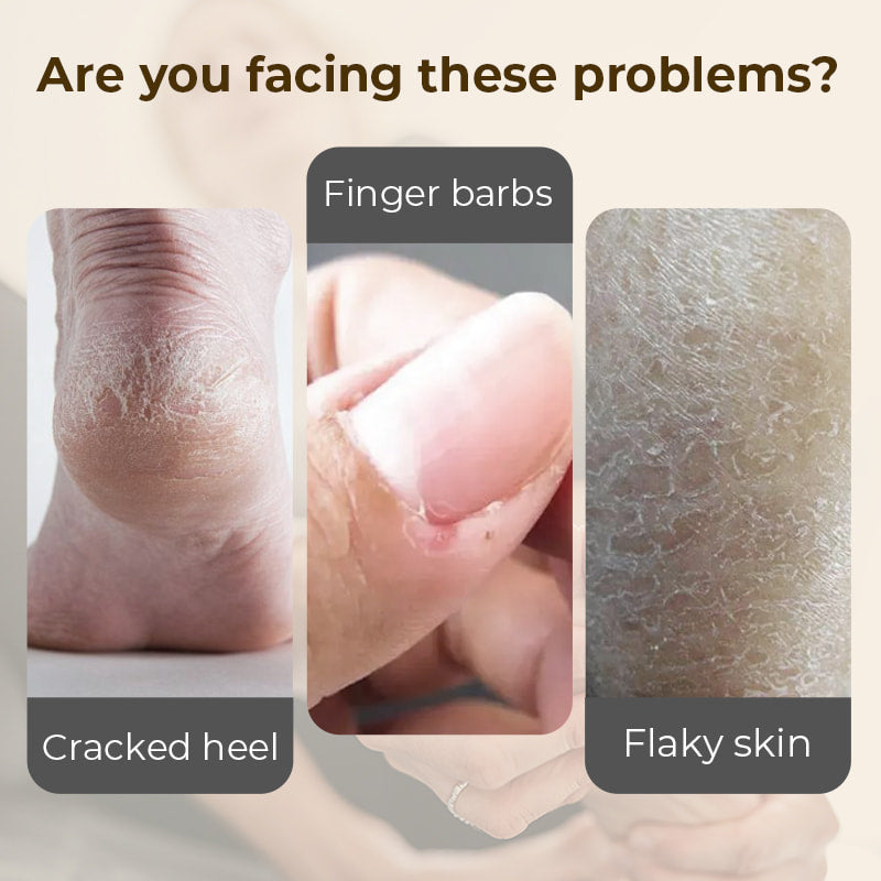 Crème hydratante et anti-gerçures pour les pieds